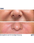 Dr. Noxton®- Anti Falten Tape- Full Face