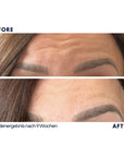 Dr. Noxton®- Anti Falten Tape- Full Face