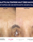 Dr. Noxton®- Anti Falten Tape- Full Face